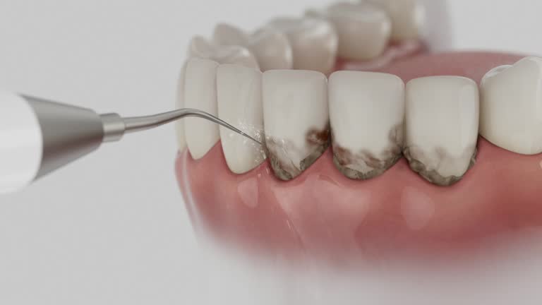 Reliable Dental contractor in Aberdeen, OH by Smile Center Dentistry